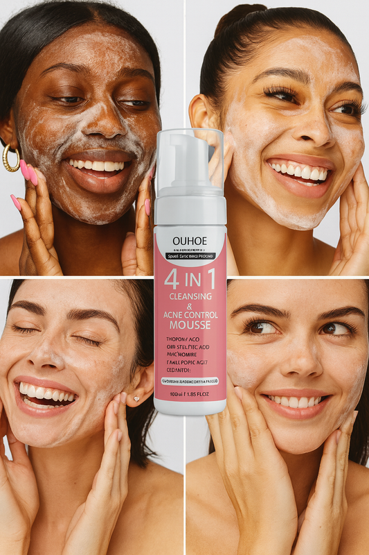 4-in-1 Cleansing & Acne Control Mousse - Deep Clean & Hydrate | OUHOE
